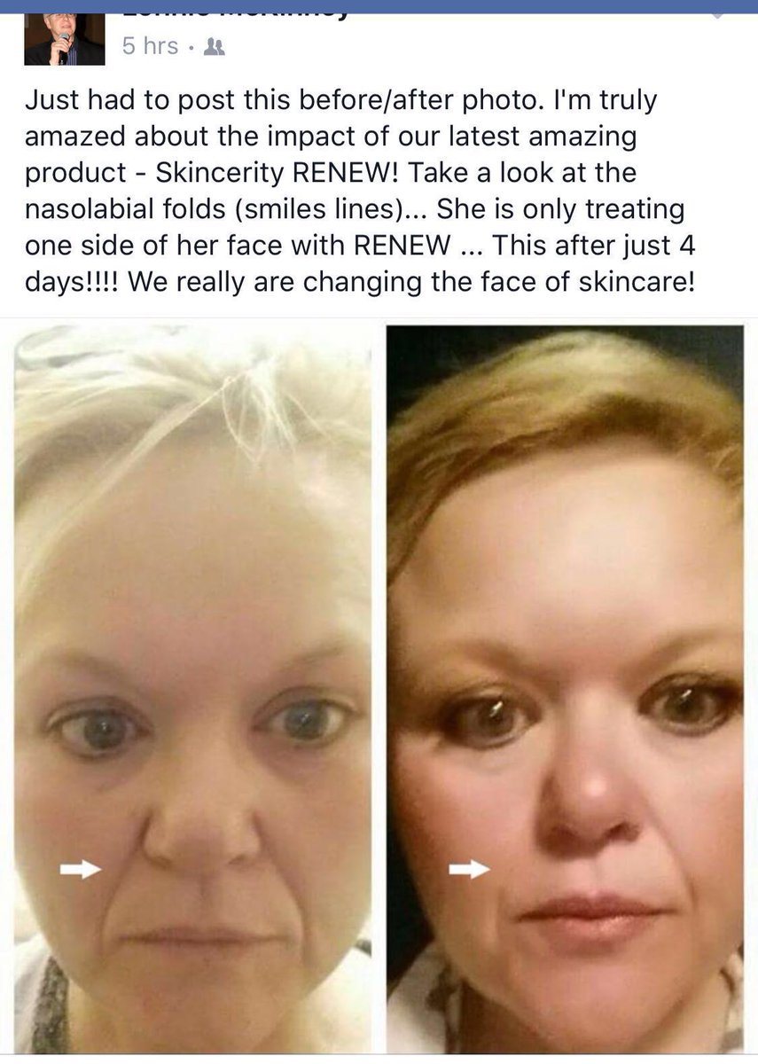 Who wants to reduce wrinkles by 63% in 4 weeks, a medical technology available here!

buynucerity. Com/245256