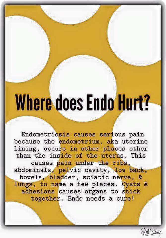 cystersgroup's tweet photo. Endometriosis is one of the few gynecological problems not spoken about. #TimeToTalk #HeatTheBloodyTruth #ReachOut ♡ https://t.co/Onughh9OBW