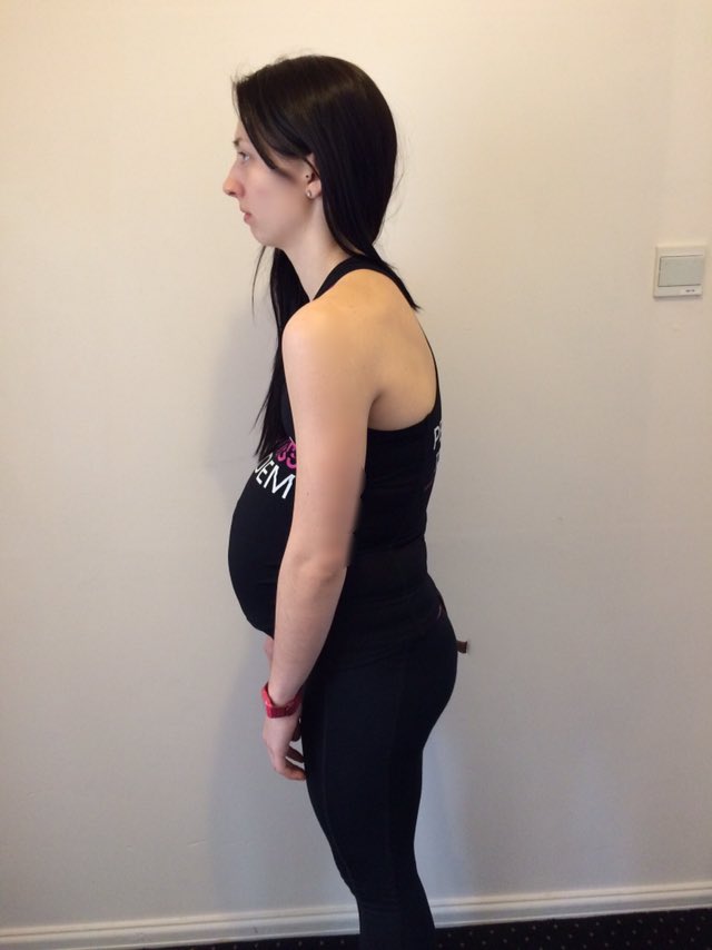 SigmaCheshire's tweet photo. Have you developed a Kyphotic posture during pregnancy? #roundshoulders #tightchestmuscles #kyphosis @BabyShows https://t.co/wQy9kw9Z7U