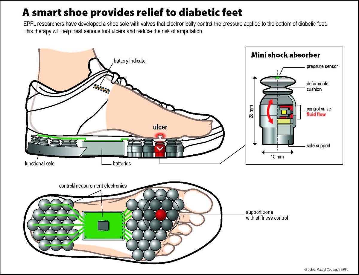 EPFL_en's tweet image. #Infographic: A smart shoe provides relief to diabetic feet actu.epfl.ch/news/diabetes-… #epflSTI