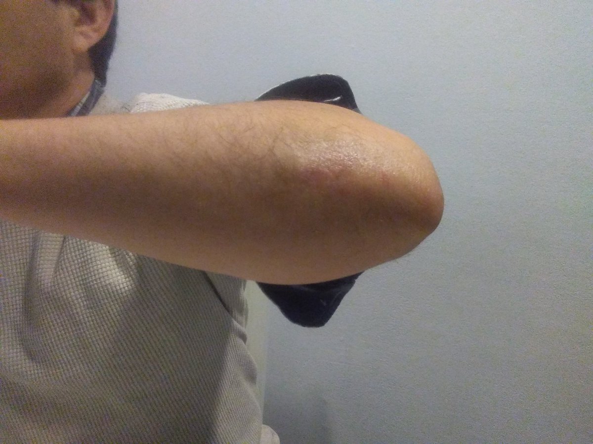 DCPsoriasis's tweet photo. Solución adecuada viene de la  naturaleza!
#tratarpsoriasis 
https://t.co/fdOmic46nS
https://t.co/WC0wokvwzw https://t.co/xwGf6d16NG