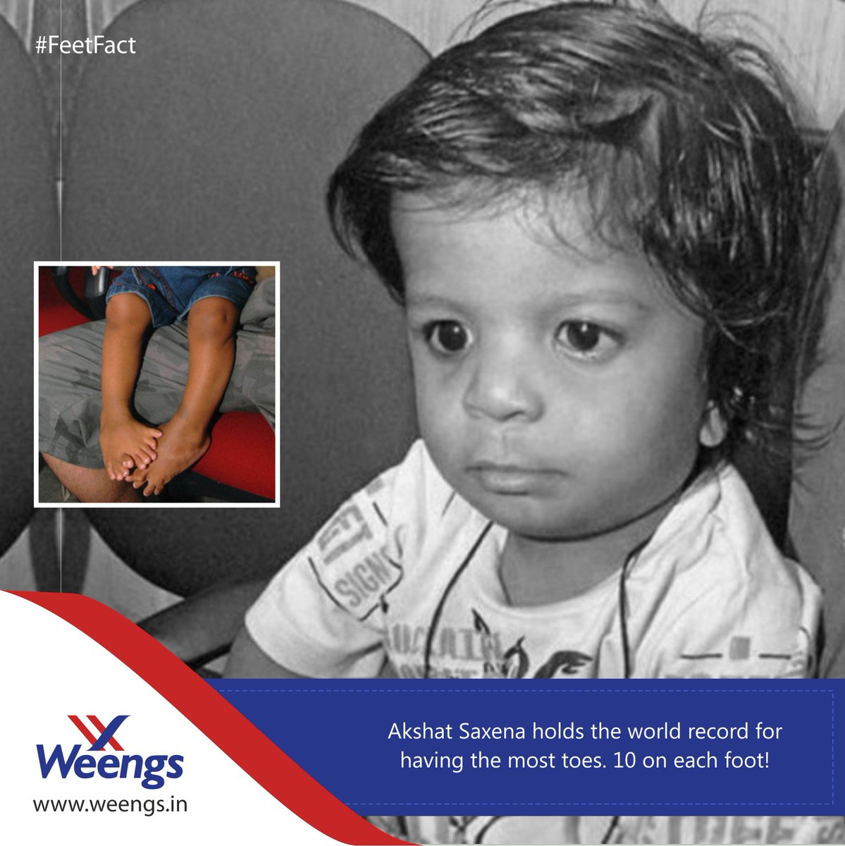 weengsindia's tweet photo. #FeetFact
A little boy named Akshat Saxena is having the most toes & holds a world record.
#weengsindia https://t.co/fF8QBgQZgA