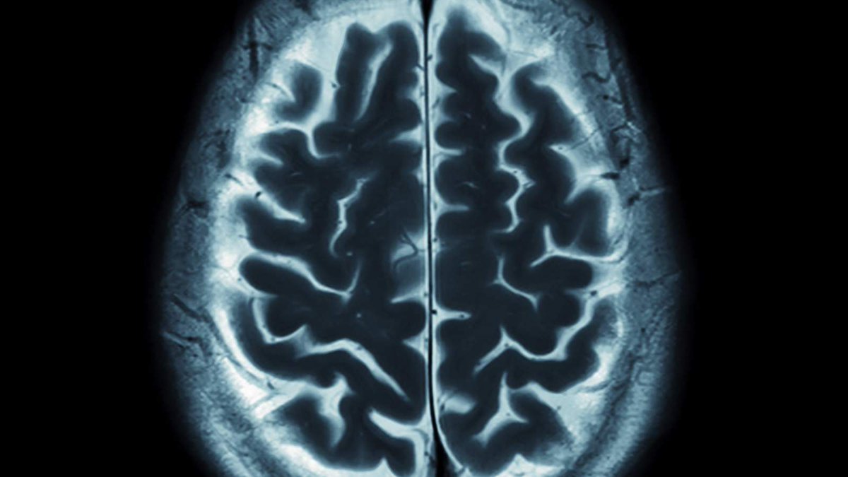 SkyNews's tweet photo. Thousands of years of brain evolution has left us addicted to Facebook and Twitter https://t.co/cBwwhaTXZg https://t.co/75M3WhTeTU