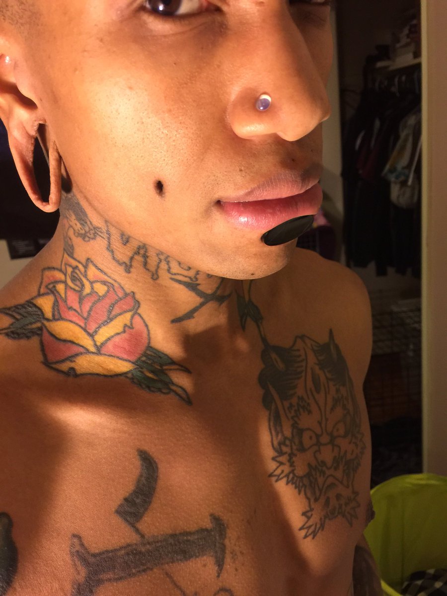 I want my philtrum done already!