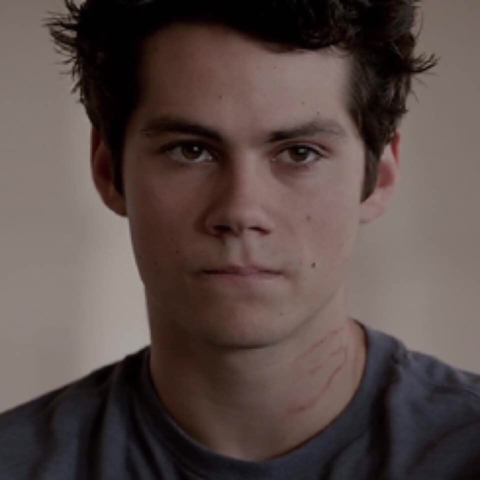 Teen Wolf (TV Series 2011–2017) - Dylan O'Brien as Stiles Stilinski,  Nogitsune - IMDb, image size:960x960