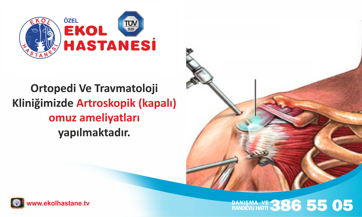 bazekolsaglik's tweet photo. Ortopedi ve Travmatoloji Kliniğimizde Artroskopik (kapalı) omuz ameliyatları yapılmaktadır. https://t.co/OHFCOOUj5c