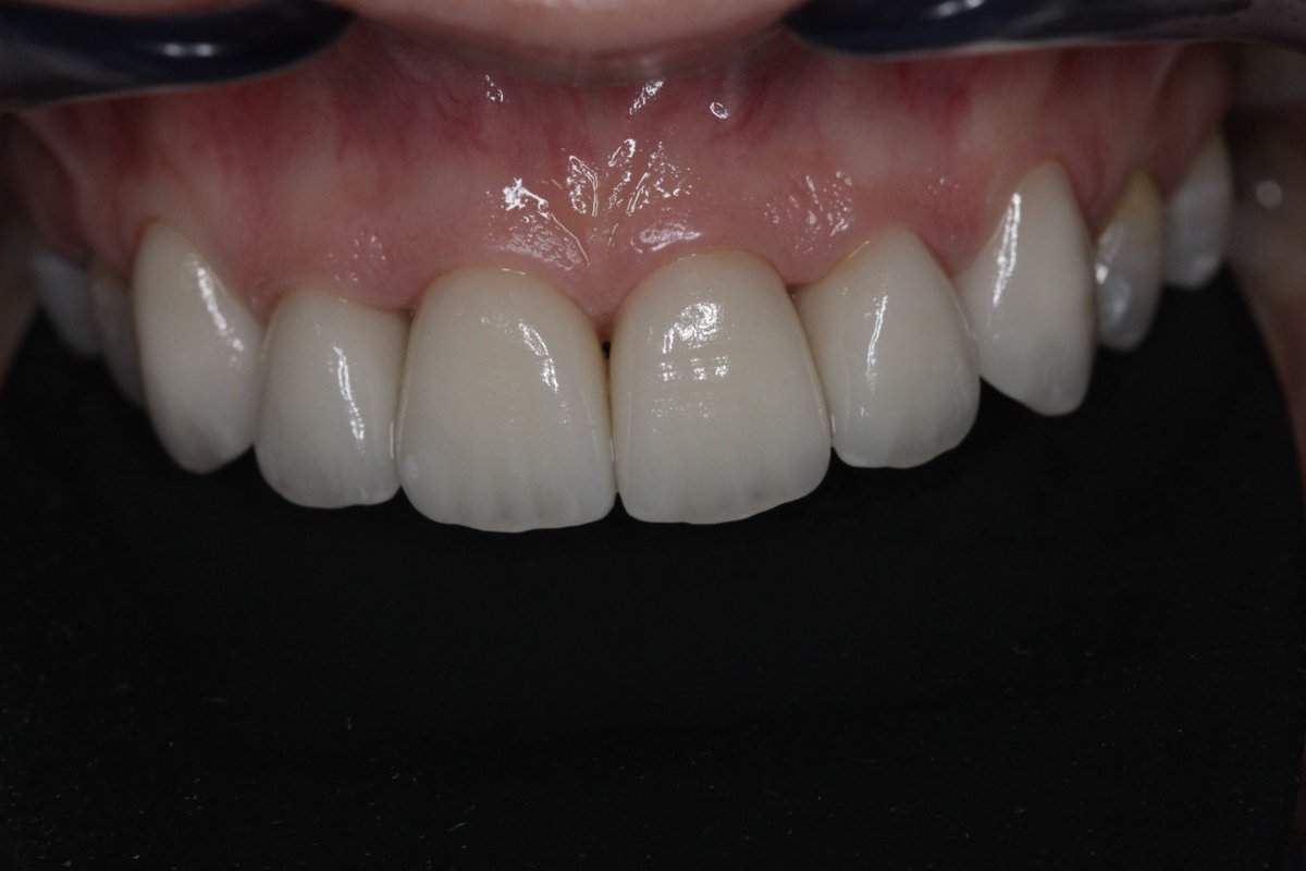 Vision Dental Lab (visiondentalab) Twitter