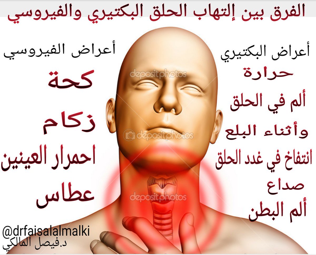 سلسلة تغريدات عن Strep Throat Amp Sore Throat إلتهاب الحلق الفيروسي Amp البكتيري الأعراض العلاج تحسين نمط الحياة علاجات منزلية Twitter Thread From د ف و از المغ امس Dr Fawazmuqamis Rattibha