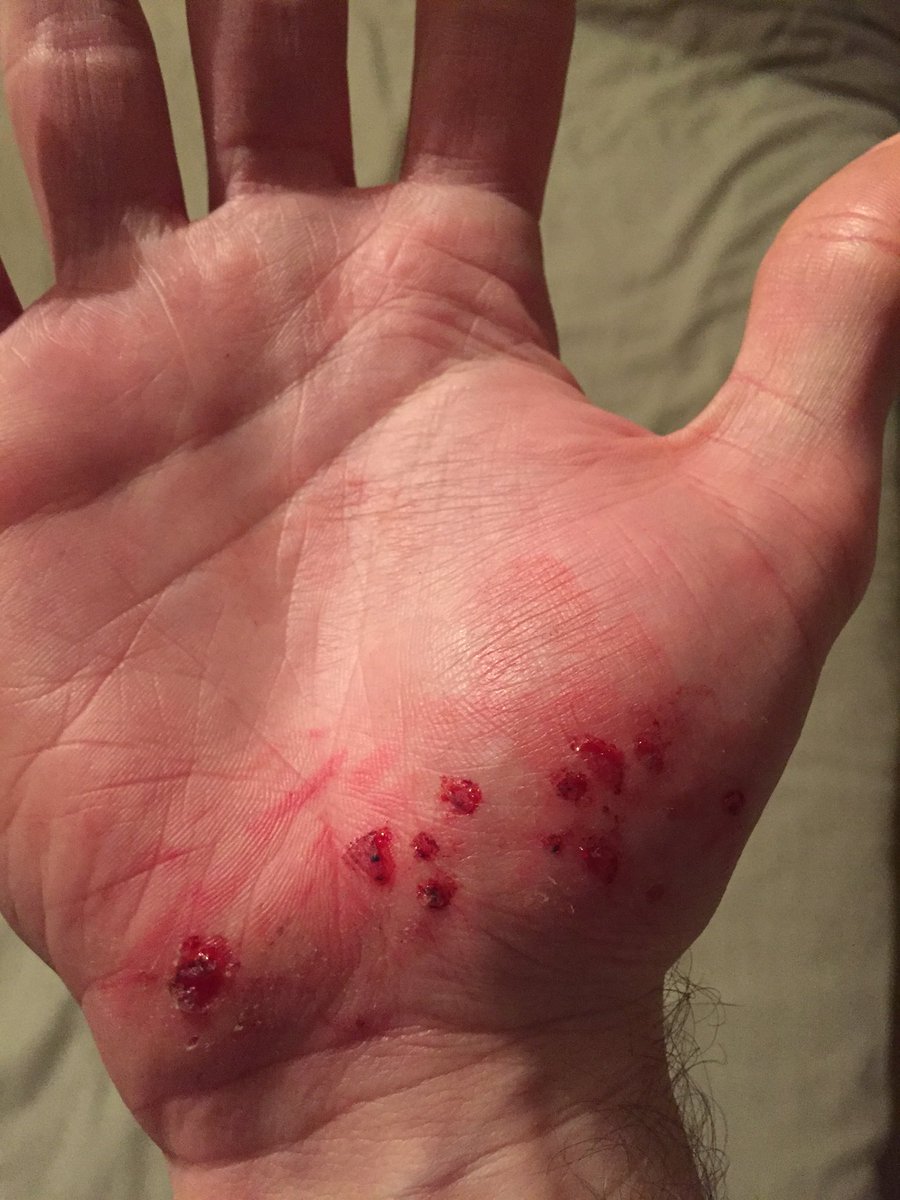ts11tt's tweet photo. I fell over. 😢 https://t.co/5kvnWTGik5