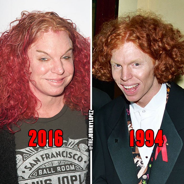 Carrot Top 1994