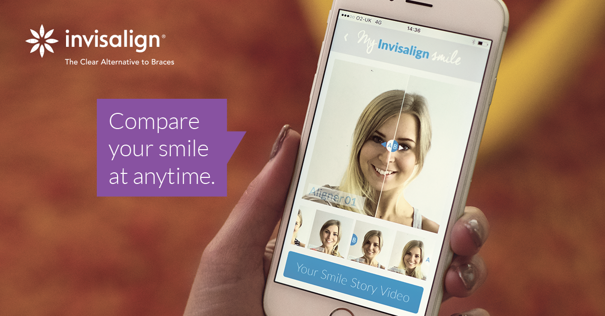 invisalign_ukie's tweet photo. 'My Invisalign Smile' is the perfect way to track and share your transformed smile in 2016. https://t.co/GeG558x5nY https://t.co/TLvmXRCopl