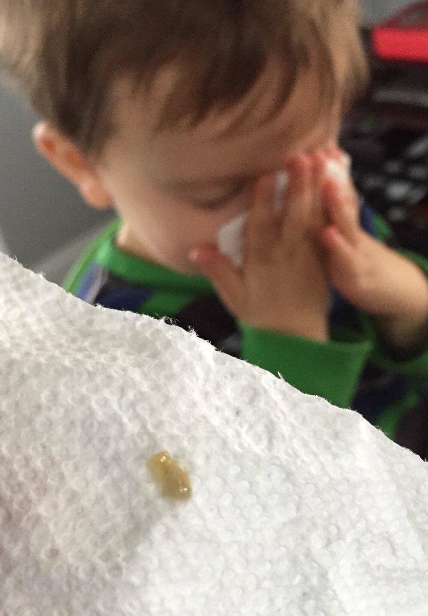 Booger boy #boogers #snotmonster #toddlersaregross