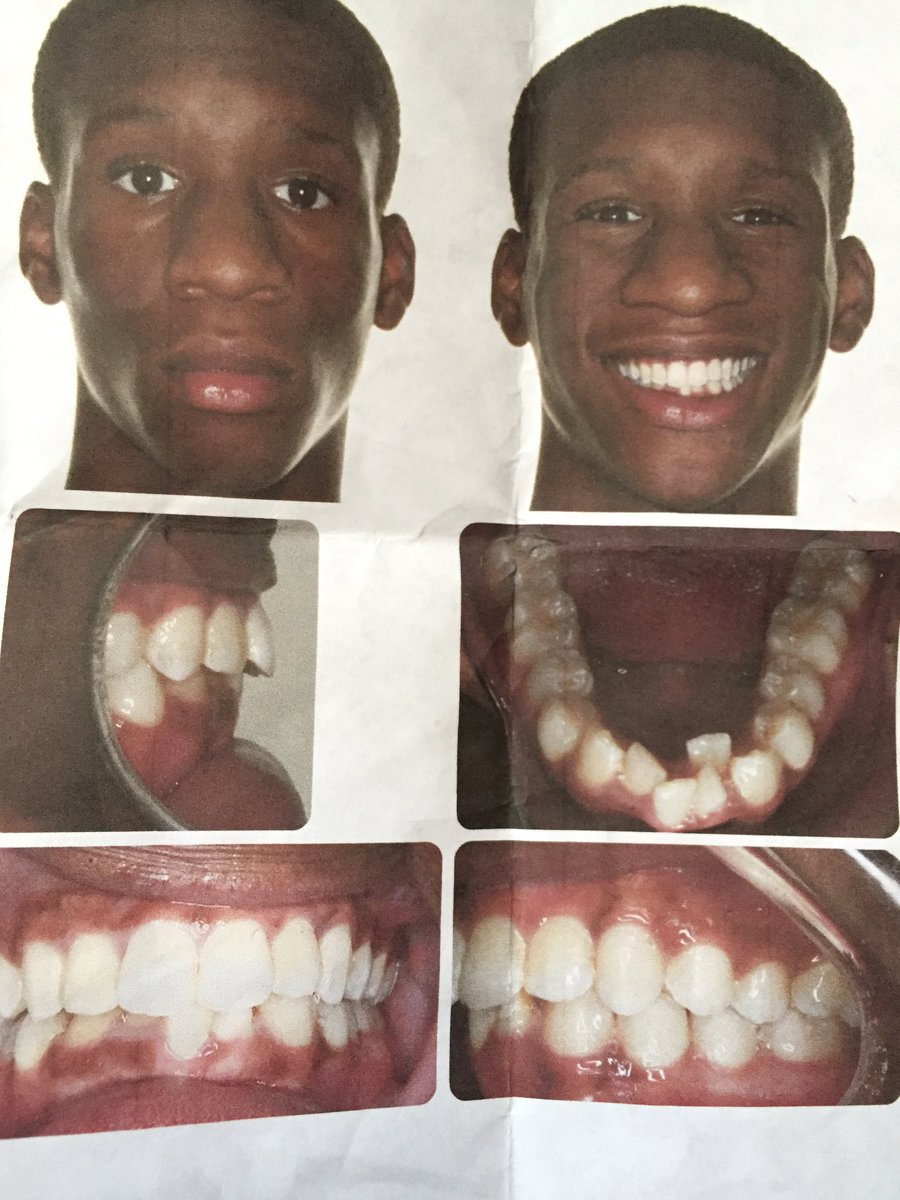ChvckG's tweet photo. My Music Is Booming. My Teeth Are Straight. Look At God. 🙏🏾🗣 https://t.co/VSeTCNhKNJ