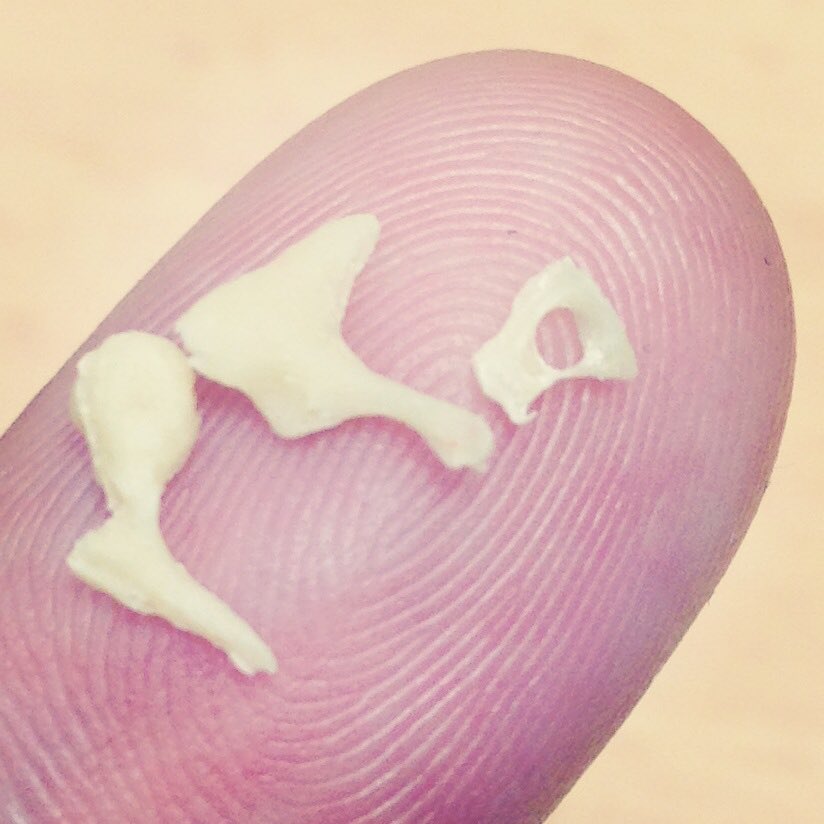 DrEricLevi's tweet photo. When we're in the middle ear, we operate in an area the size of our fingertip. We love it! #ENTsurgery https://t.co/9o2Bkkx3sr