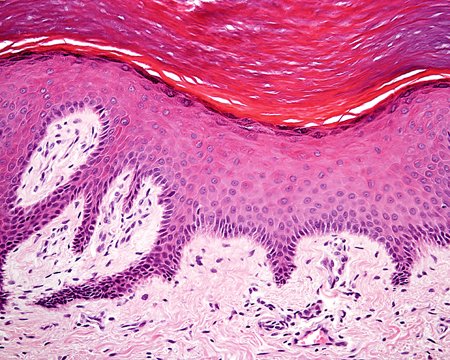 bl_journal's tweet photo. Mike Murphy &amp; Per-Arne Torstensson discuss the heating of #skin at different temperatures https://t.co/0unbMs2XzA https://t.co/Xfq4LOtpMA