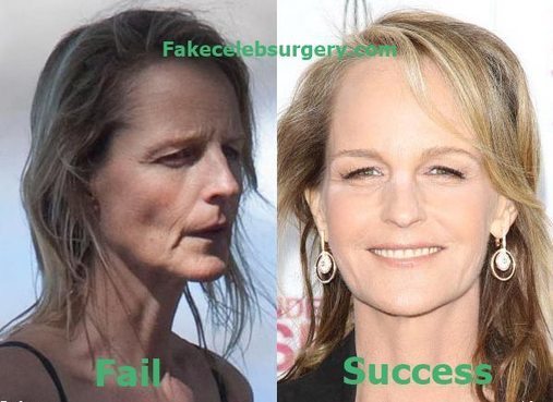 Plastic Surgeon Az 2plasticsurgeon تويتر