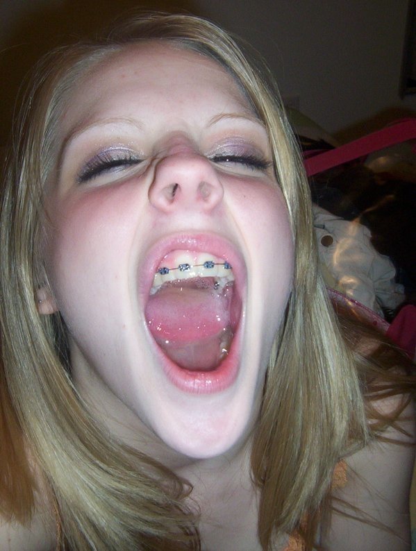 Braces Cum 80