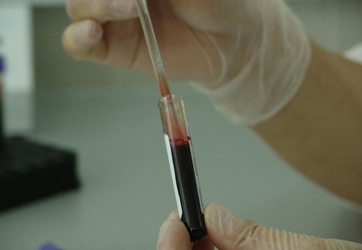 abierta_tv's tweet photo. Alemania: Crean medicamento que elimina el VIH en células infectadas. https://t.co/o4cRDZwxlX https://t.co/0oqJzUNxz4