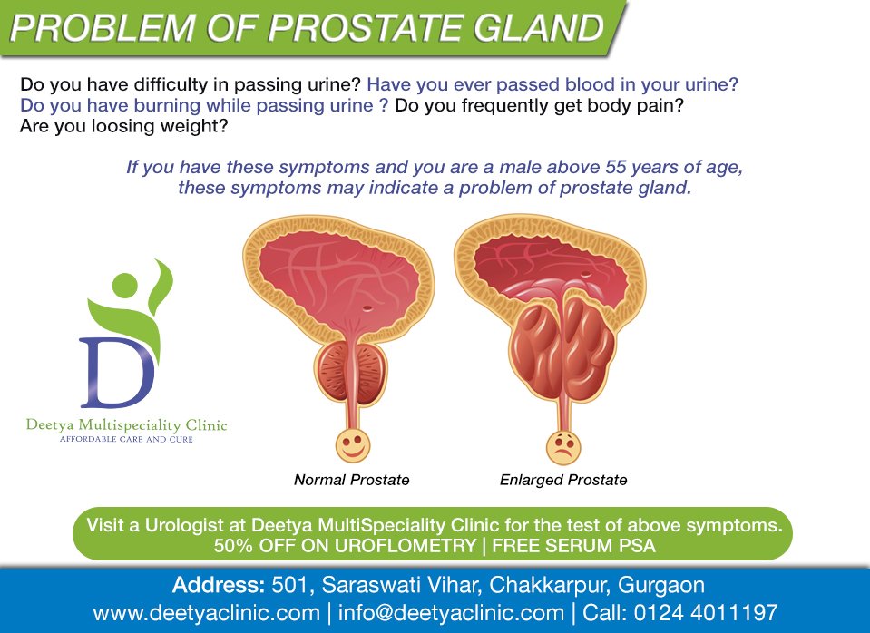 deetyaclinic's tweet photo. #prostate #problem ?? visit us now https://t.co/b5rJfF1LI6