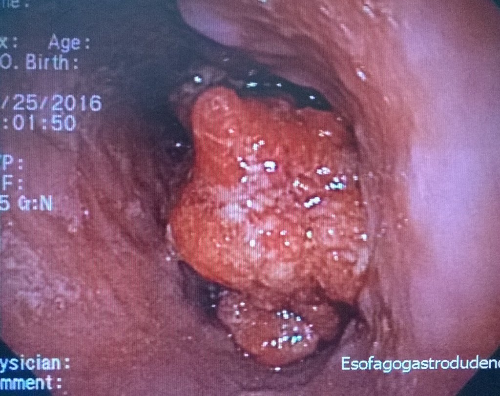 pg_saavedra's tweet photo. @agaviriau @antoniotoro @meisseralberto @Gracevilla2015 Las #EPS serían el #inmundo #cáncer que #corroe al #sistema https://t.co/qOxHIPWuvp