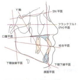 カンペル平面 JapaneseClass.jp