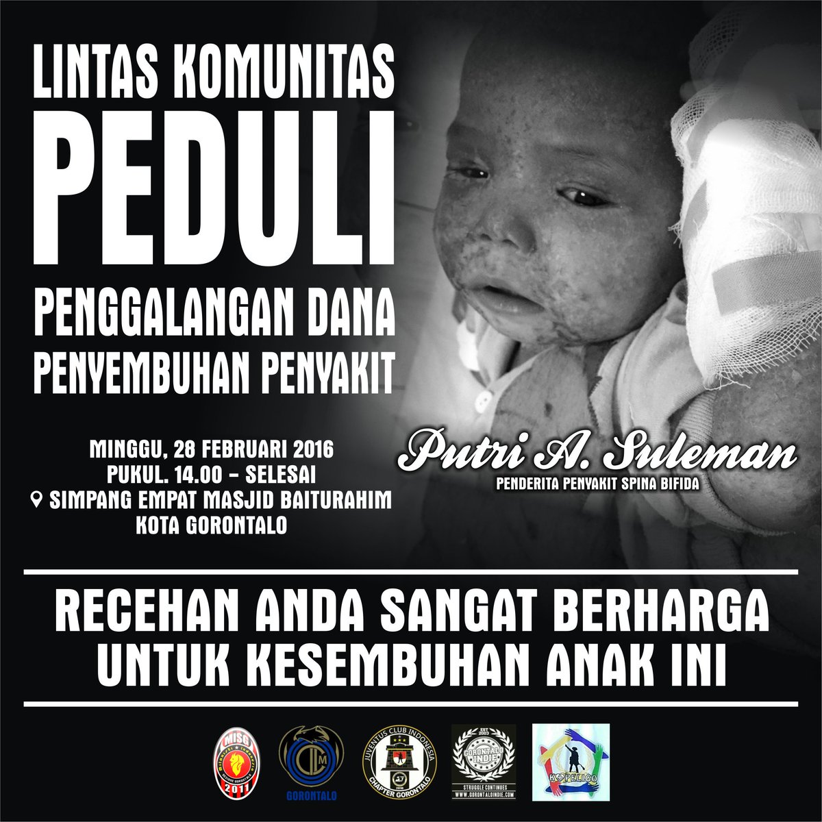 Besok milaners hulonthalo akan ikut penggalangan dana untuk adik kita Putri A. Suleman #MIsGPeduli