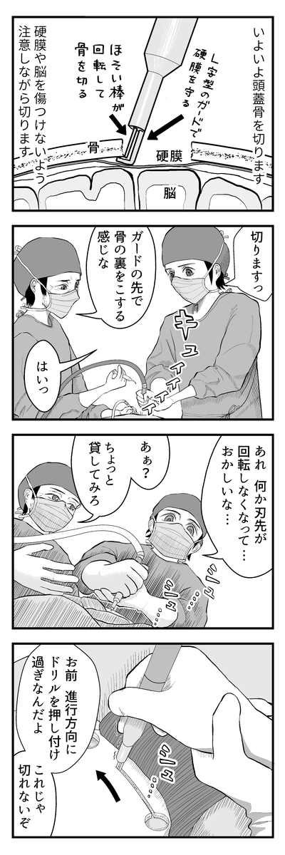 ブログ更新のお知らせ→ のうげかなう。 : 057 はじめての開頭手術11 クラニオトーム(全8コマ) https://t.co/qqBrh34QT7 