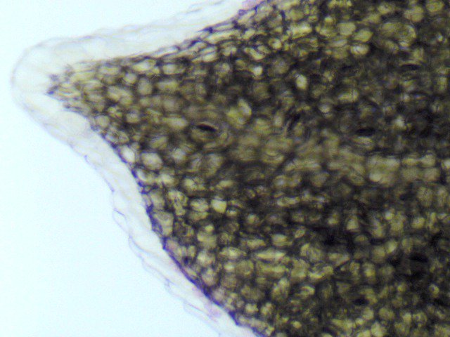 Micros_world's tweet photo. Acacia nilotica adstringens leaf 100x https://t.co/bEfV47QSxT