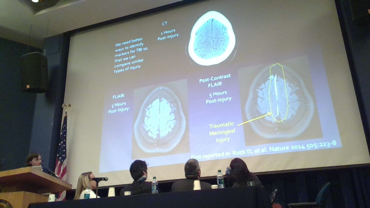 Turtzo: Traumatic Meningeal Injury - unique to mTBI in imaging. #pinkTBI