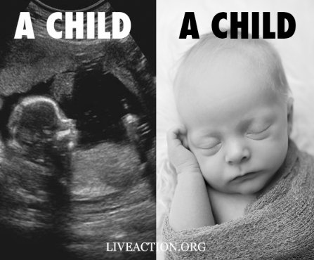 LilaGraceRose's tweet photo. A child is a human being inside and outside of the womb. Location shouldn't determine whether they live or die. https://t.co/l4RYlliMZJ