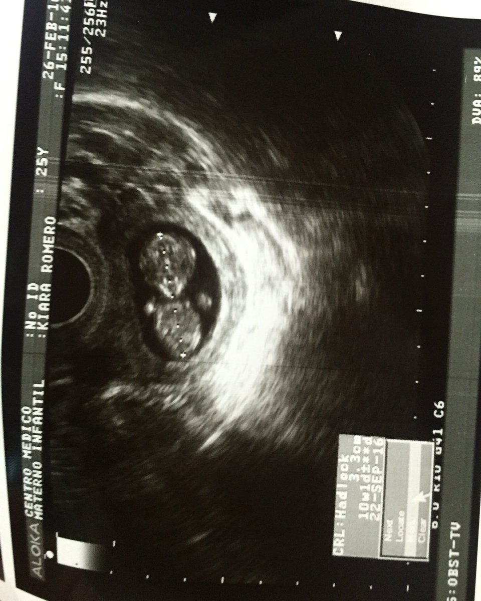 Es lo mas hermoso que han visto mis ojos... Mi bebe, mi amor, mi vida... ♥️🙏👶🏽