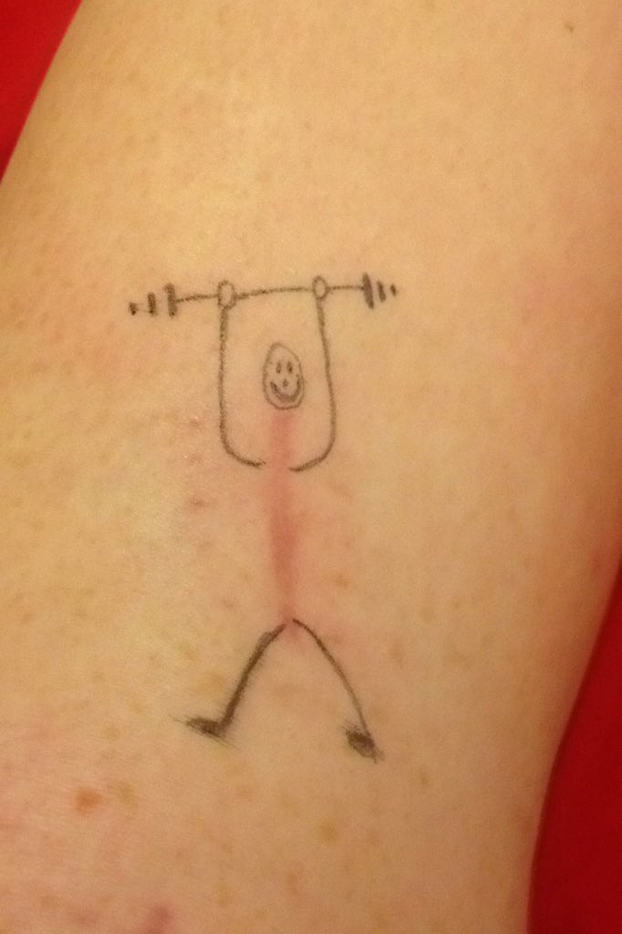 mufcjen07's tweet photo. Scar art ! #ACL @ACLInjuryRehab @ACL_life @ACLMotivesNow https://t.co/zEfpfkB8nH