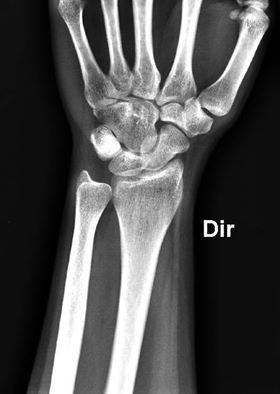 RadiologySigns tweet picture