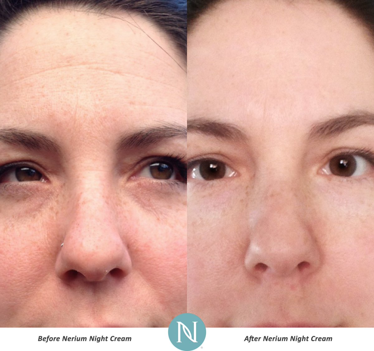 BeautifyNMB's tweet photo. Not every skincare product can give you Real Results, but Nerium Age-Defying Cream can: https://t.co/JXwxeAriOm https://t.co/2pcPqkPk2e
