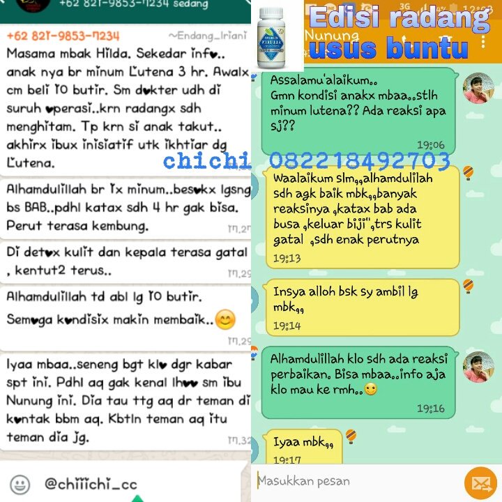 itmesuci_88's tweet photo. 3hari minum SLutena kondisi si Anak membaik "radang usus buntu"
#SLutena #NutrisiAlami #bukanObat #tanpaefeksamping https://t.co/55tmcCLrJn