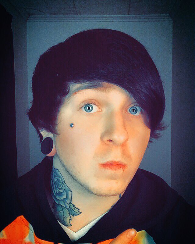 promises_unsaid's tweet photo. So Edjo Promises got his dermal done. what do you think guys? https://t.co/Fcti5LmOuv