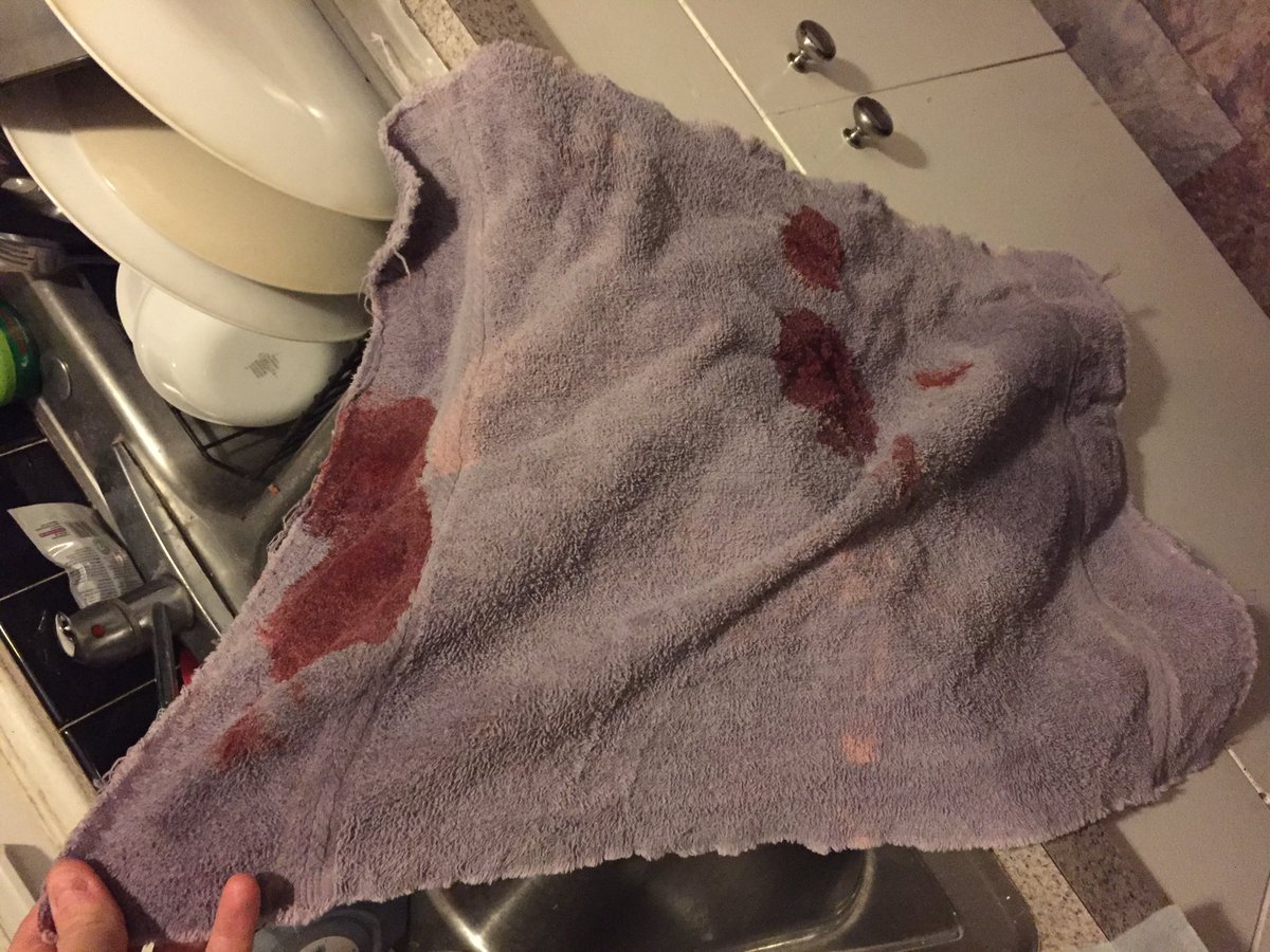 heather_adams_'s tweet image. I stepped on glass today no I'm in pain meds...#funtweets