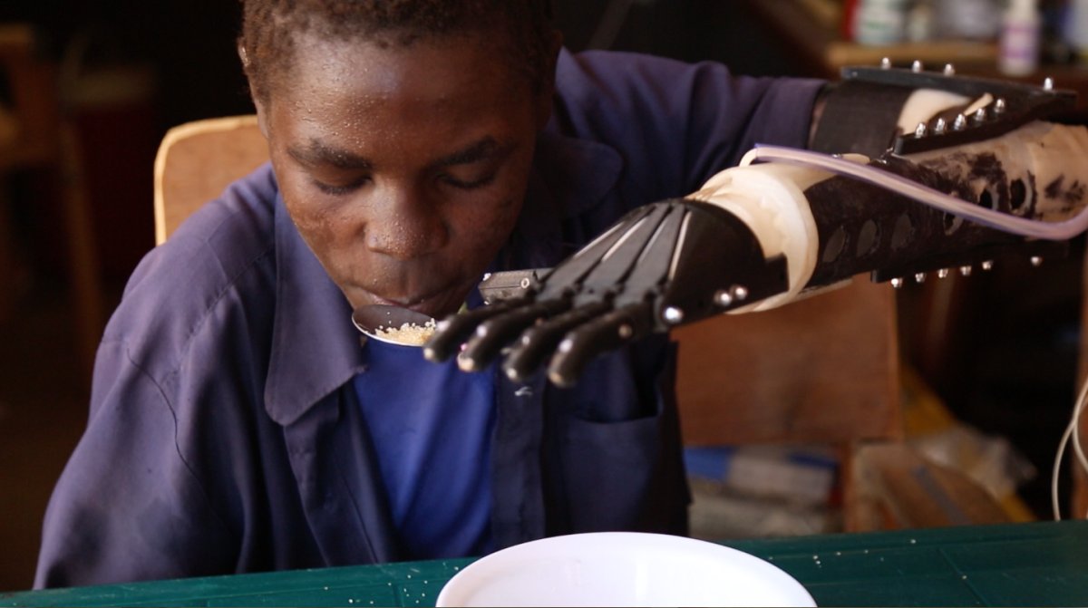 huggg_uk's tweet image. Incredible work @MichaelEbeling &amp;amp; #NotImpossible in #SouthSudan. youtube.com/watch?v=SDYFMg… #ProjectDaniel #worldhuggg