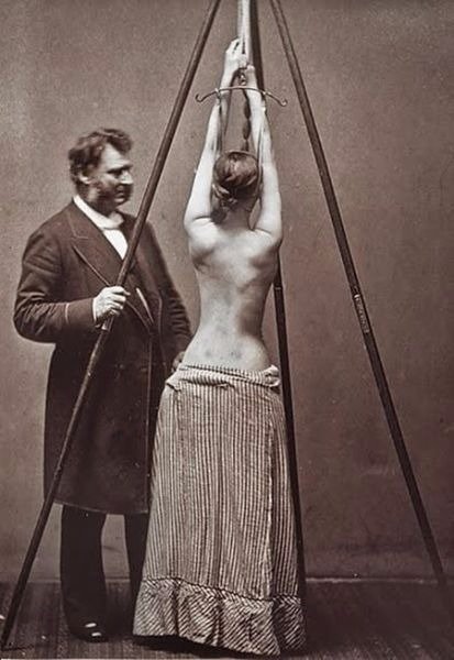 RealHorrorStuff's tweet photo. Medical treatment against scoliosis https://t.co/o17frbaiAt