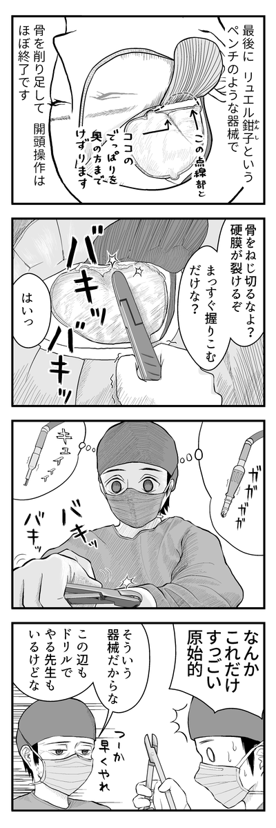 ブログ更新のお知らせ→ のうげかなう。 : 059 はじめての開頭手術13 ふと気づいた https://t.co/SvajZm6Ftg 