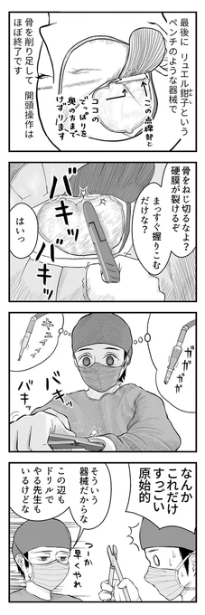 ブログ更新のお知らせ→ のうげかなう。 : 059 はじめての開頭手術13 ふと気づいた https://t.co/SvajZm6Ftg 