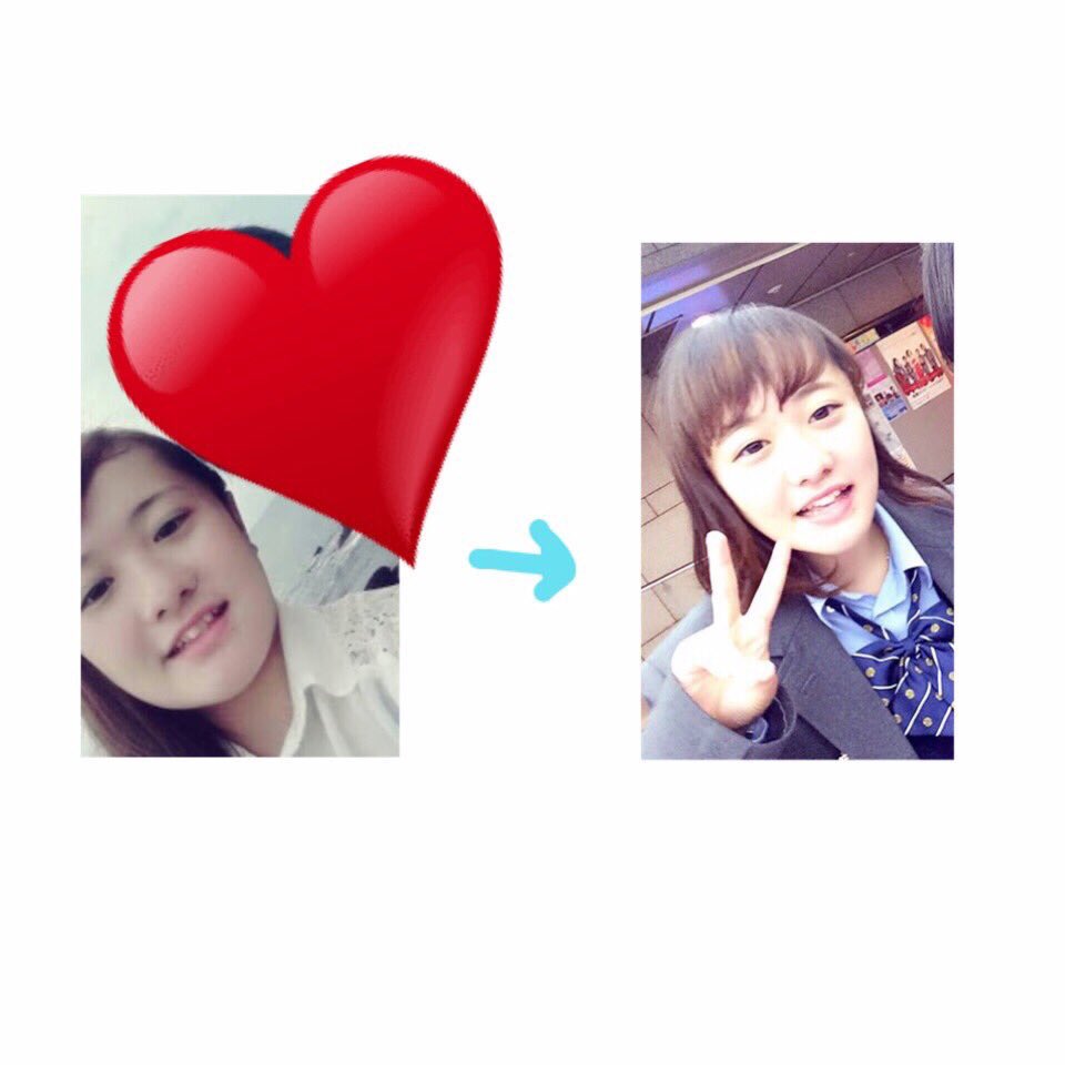 Rei ふるちゃんず ひなた家 ダイエットスタートは1月16日 日向美香ちゃん式ﾀﾞｲｴｯﾄしました 顔の変化 体型の変化 足の変化 わかりますか 日向美香 変わったと思ったらrt いいね 気になった人フォローします T Co zktfandi Twitter
