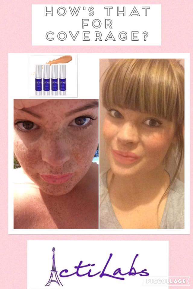 Kaysactiderm's tweet photo. stunning foundation coverage #makeup #foundationmakeup #getthelook #makeupproducts 
Message for information https://t.co/9y2bKO7yQw