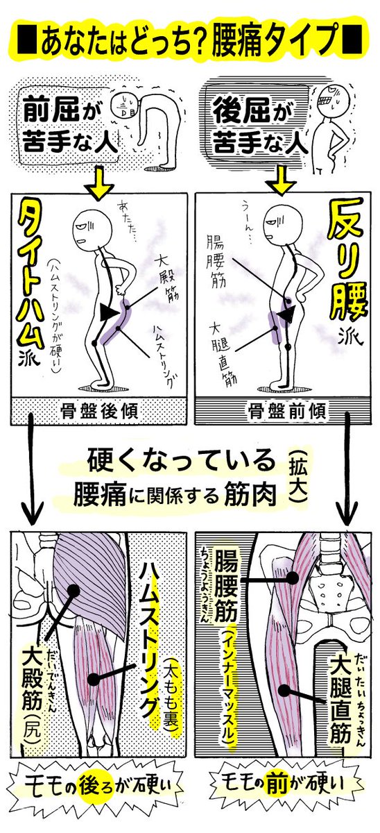 「あなたはどっち?腰痛タイプ」とか言ってますが、私は後屈苦手の「反り腰派」です。そして、ヤバめの腰の痛みが発生すると「タイトハム派」と「反り腰派」の二刀流になります。涙
つづき →https://t.co/EwWtzodnkb
