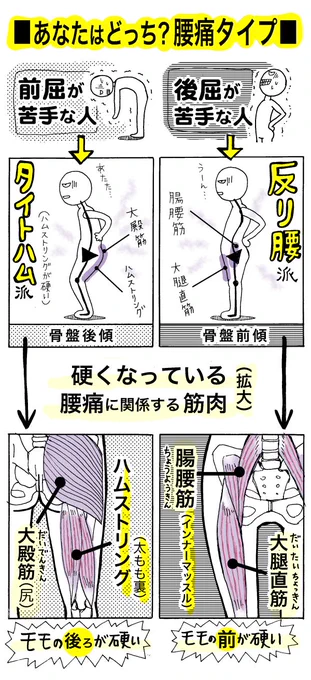 「あなたはどっち?腰痛タイプ」とか言ってますが、私は後屈苦手の「反り腰派」です。そして、ヤバめの腰の痛みが発生すると「タイトハム派」と「反り腰派」の二刀流になります。涙
つづき →https://t.co/EwWtzodnkb 