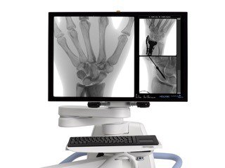 Hologic's tweet photo. Visit Hologic tomorrow at @AAOSAnnual booth 2937 to see the BIGGER PICTURE with InSight FD Mini C-arm! #AAOS2016 https://t.co/8DHkNRDzcn
