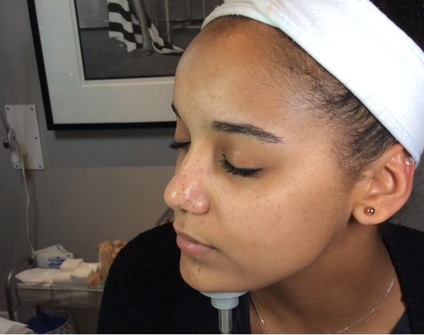 SpaIncMag's tweet photo. We reviewed a Varilite laser treatment at @Avenue_SkinCare #testdivas #touchuptuesday https://t.co/nhIAqwuljN https://t.co/1gvOC2kpNr
