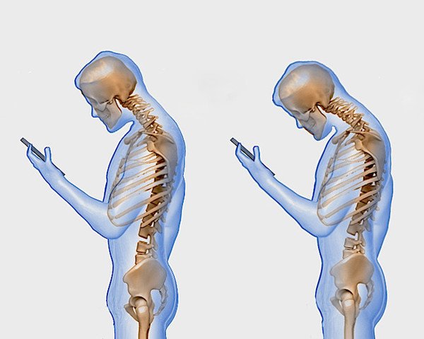 WomensHealthMag's tweet image. Here's what texting really does to your spine: spr.ly/6011BdVQb