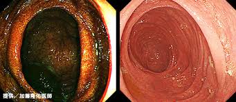 mikeo168's tweet image. 【便秘で悩んでる人必見】
便秘歴４０年を克服した経験を元に
便秘の種類と便秘薬の選び方を
まとめました。無料で見れます。
ダウンロードしてご覧ください。
bit.ly/1Tm9KCq
#ダイエッター　#便秘