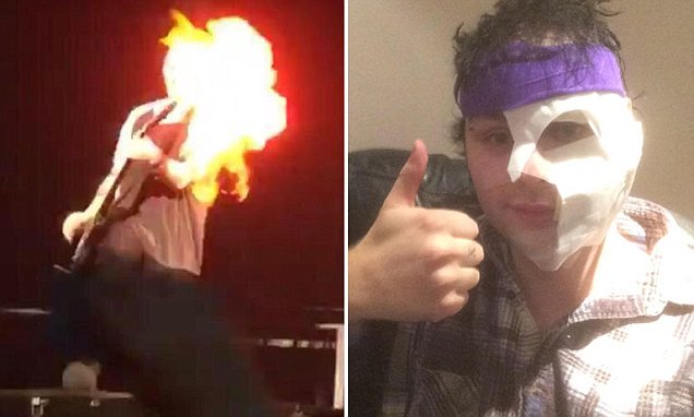 youwerehere_'s tweet photo. when Michael got burnt during ROWYSO tour in Wembley arena https://t.co/l8QMr8porJ